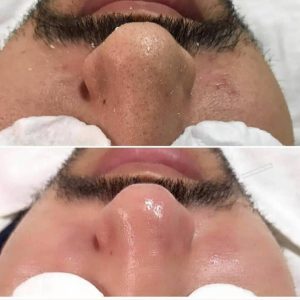 Asu Güzellik Salonu