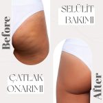 Beauty Concept by BT