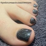 Pedicure in Antwerpen