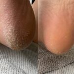 Pedicure in Antwerpen