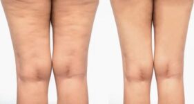 Asu Güzellik Salonu