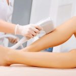 Laserontharing Quincy