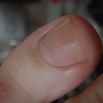 Pure Elegance x Pedi by Alexia